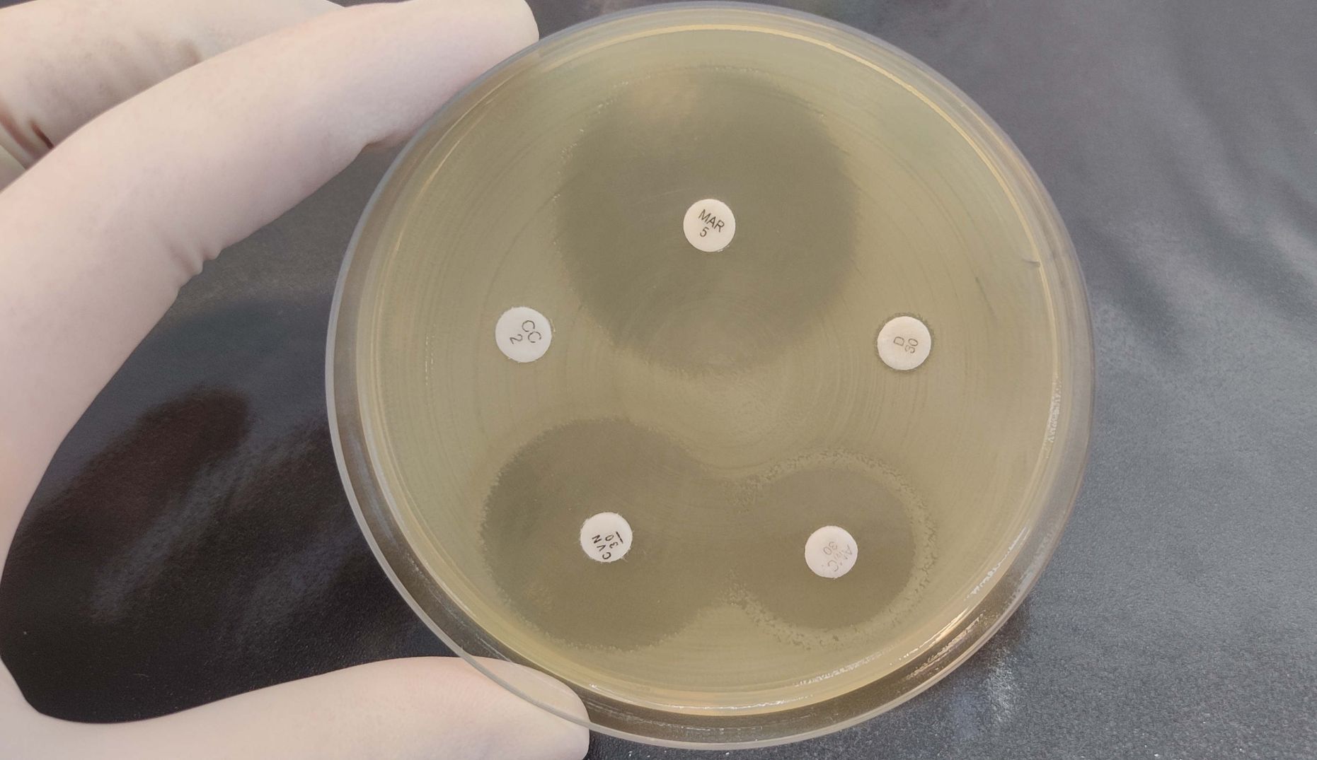 Foto: Antibiogramm naitab antibiootimumide mõju bakteritele