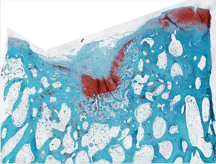 Kontrollkõhr (värvitud safraniiniga) defektiga ülemises vasakus servas. Foto: Samuel I. Stupp, Northwestern University.